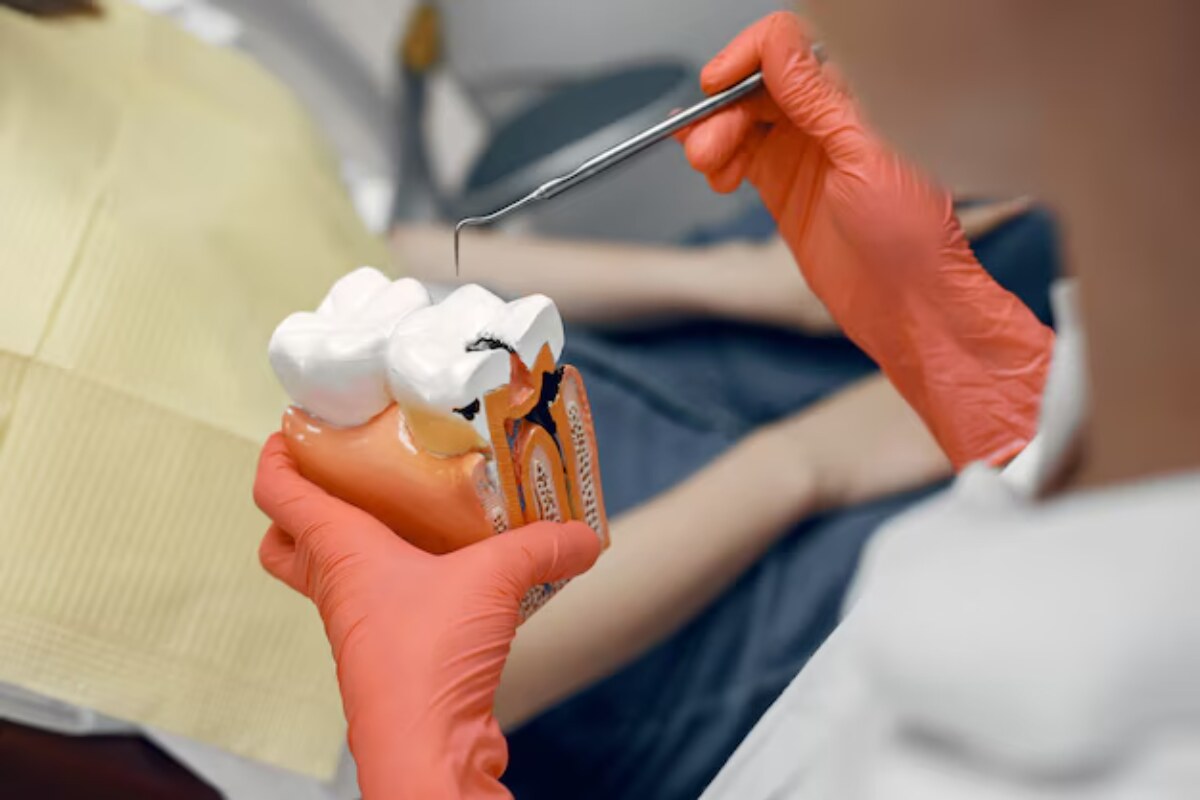 things you should know about the dental fillings in georgetown